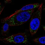 Atlas Antibodies Anti-RRAS Antibody