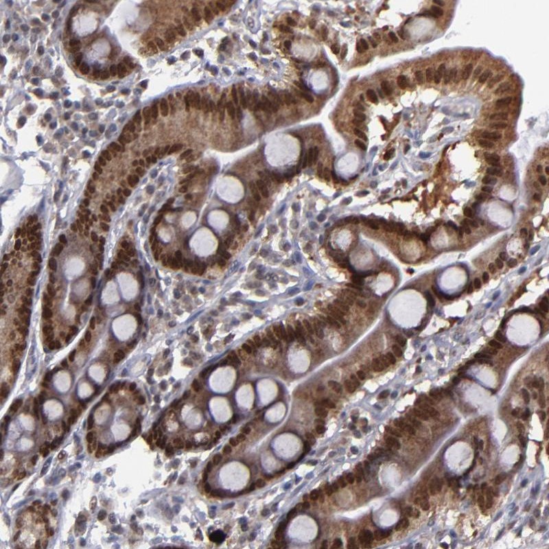 Atlas Antibodies Anti-RREB1 Antibody