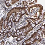 Atlas Antibodies Anti-RREB1 Antibody