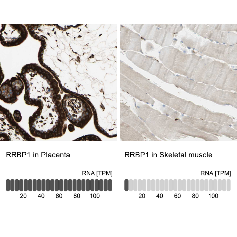 Atlas Antibodies Anti-RRBP1 Antibody