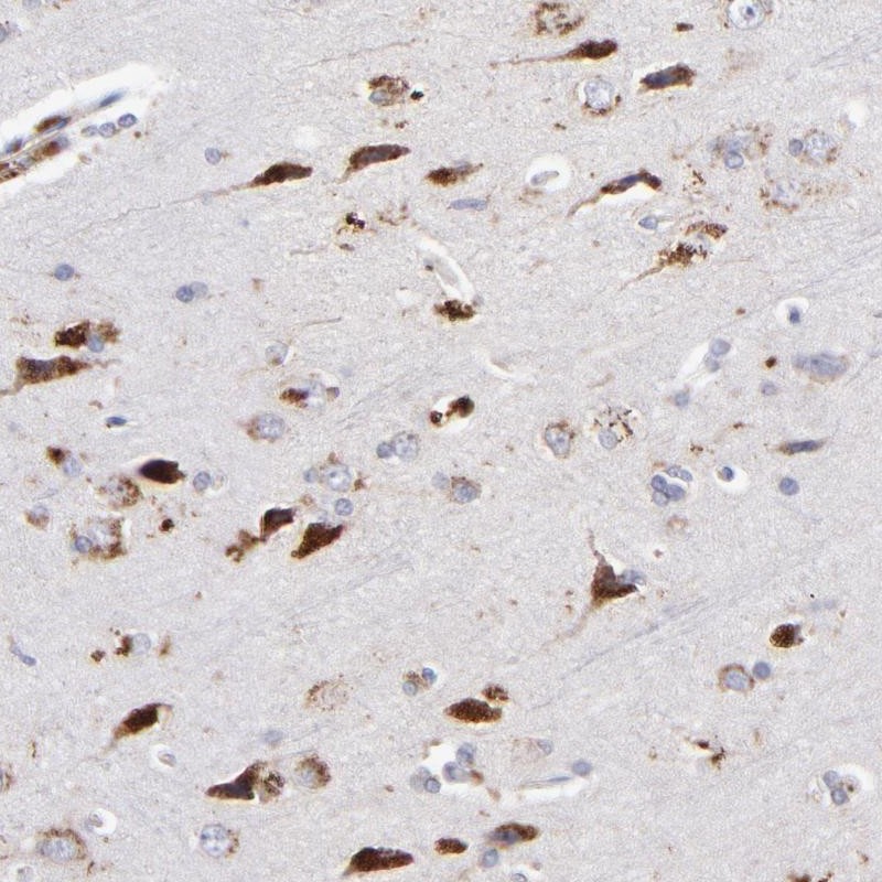Atlas Antibodies Anti-RRAGA Antibody