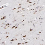 Atlas Antibodies Anti-RRAGA Antibody