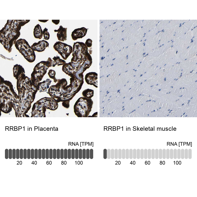 Atlas Antibodies Anti-RRBP1 Antibody