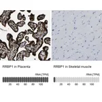 Atlas Antibodies Anti-RRBP1 Antibody