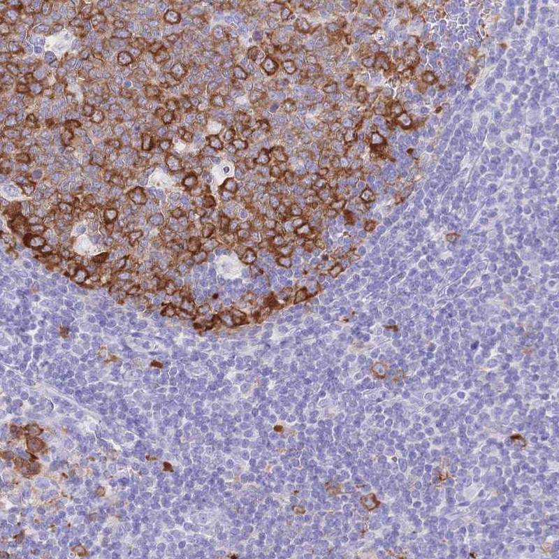Atlas Antibodies Anti-RRM1 Antibody
