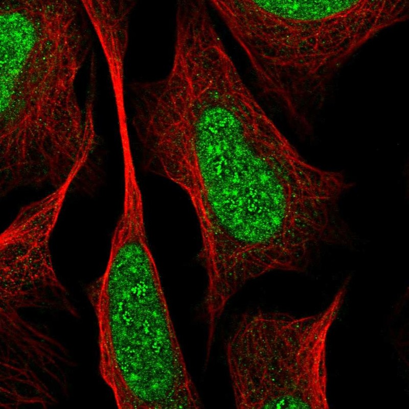 Atlas Antibodies Anti-RREB1 Antibody
