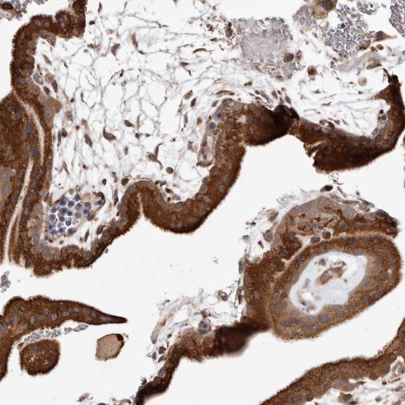 Atlas Antibodies Anti-RRM2B Antibody