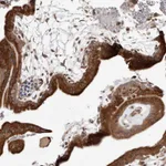 Atlas Antibodies Anti-RRM2B Antibody
