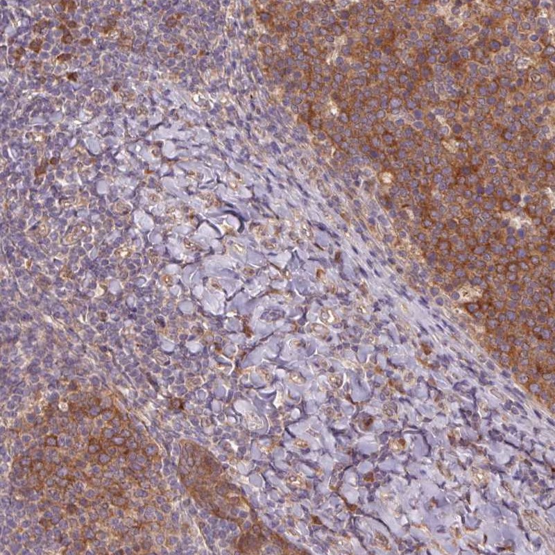 Atlas Antibodies Anti-RRM1 Antibody