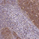 Atlas Antibodies Anti-RRM1 Antibody