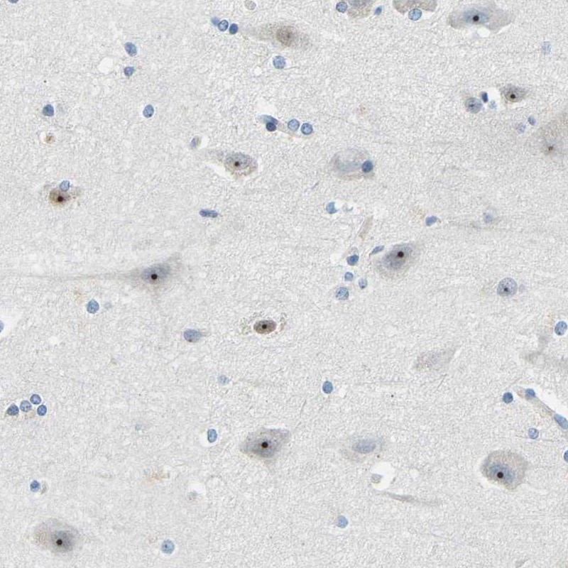 Atlas Antibodies Anti-RRP1 Antibody