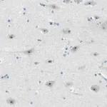 Atlas Antibodies Anti-RRP1 Antibody