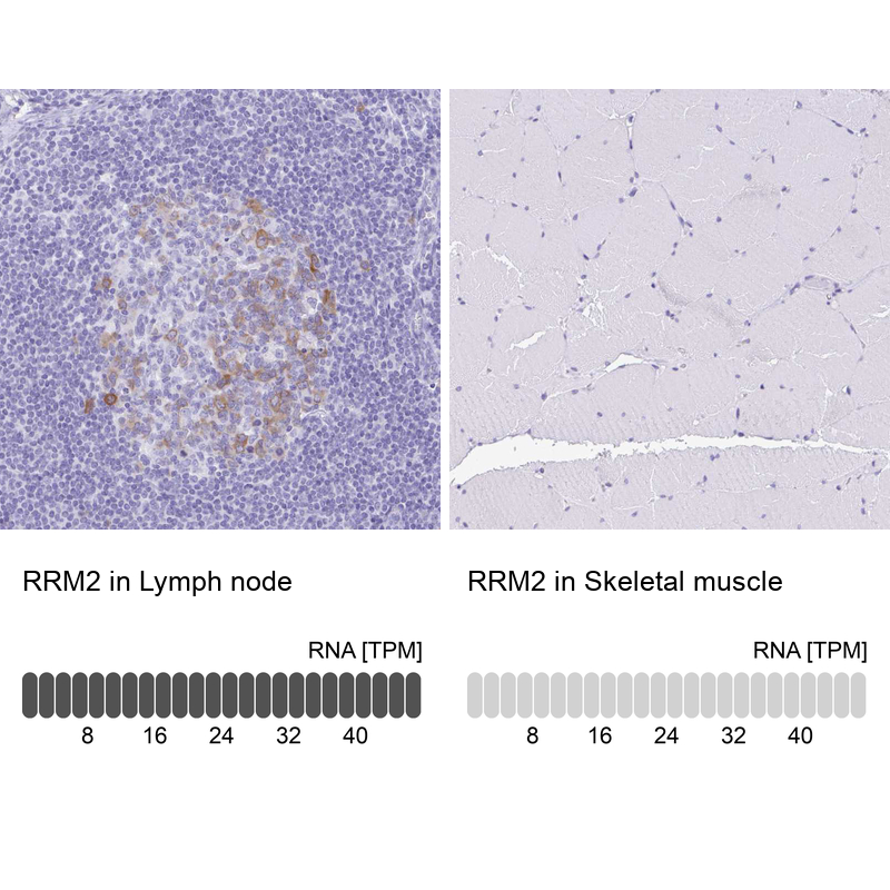 Atlas Antibodies Anti-RRM2 Antibody