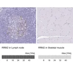 Atlas Antibodies Anti-RRM2 Antibody