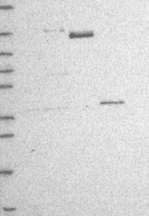 Atlas Antibodies Anti-RRP12 Antibody