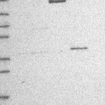 Atlas Antibodies Anti-RRP12 Antibody