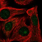 Atlas Antibodies Anti-RRP12 Antibody
