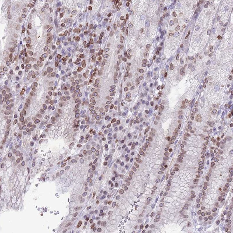 Atlas Antibodies Anti-RRNAD1 Antibody
