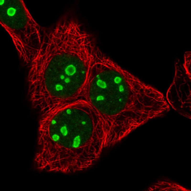 Atlas Antibodies Anti-RRN3 Antibody