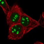 Atlas Antibodies Anti-RRN3 Antibody
