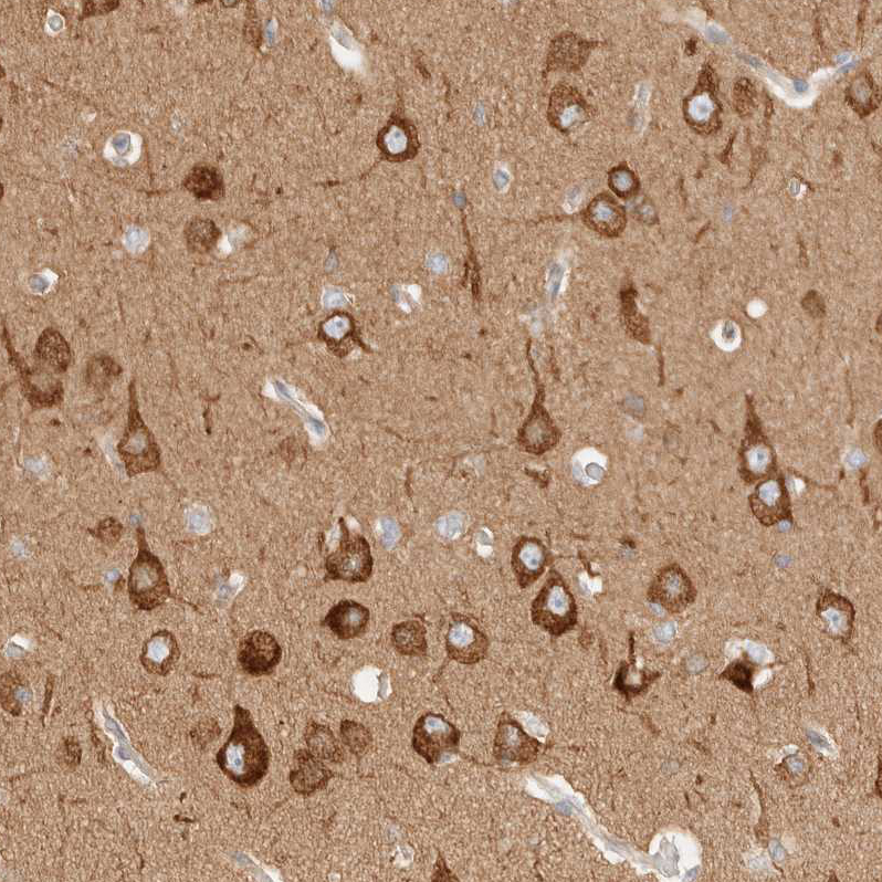 Atlas Antibodies Anti-RRP15 Antibody