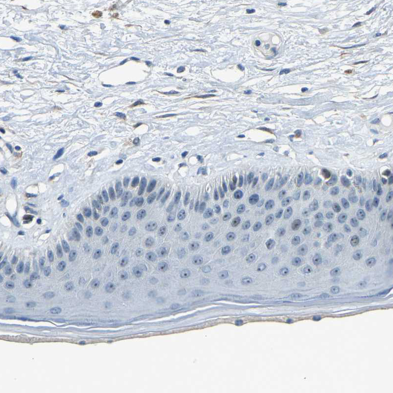 Atlas Antibodies Anti-RRP1 Antibody