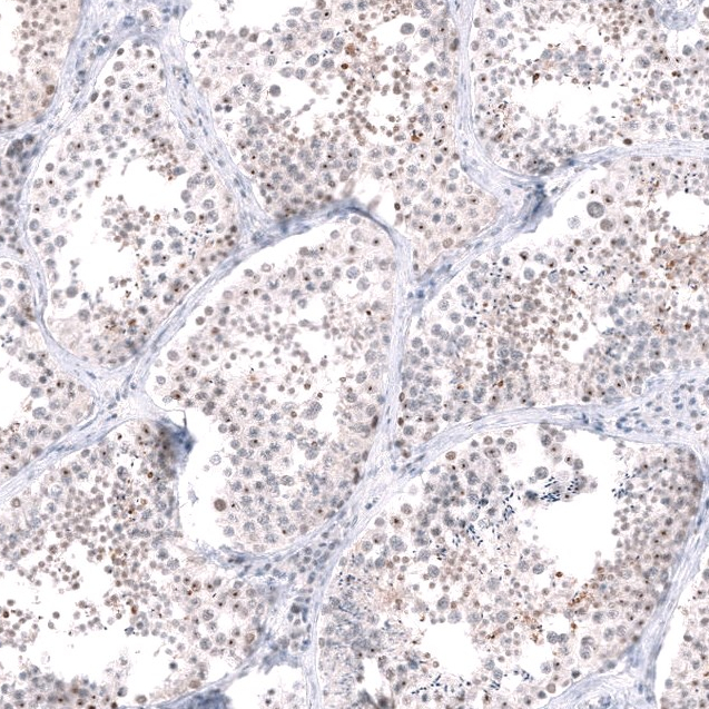 Atlas Antibodies Anti-RRP1B Antibody