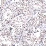 Atlas Antibodies Anti-RRP1B Antibody