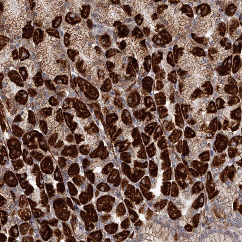 Atlas Antibodies Anti-RRP36 Antibody