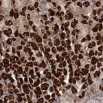 Atlas Antibodies Anti-RRP36 Antibody