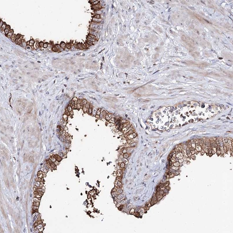 Atlas Antibodies Anti-RRP9 Antibody