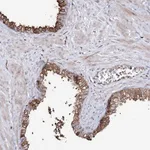 Atlas Antibodies Anti-RRP9 Antibody