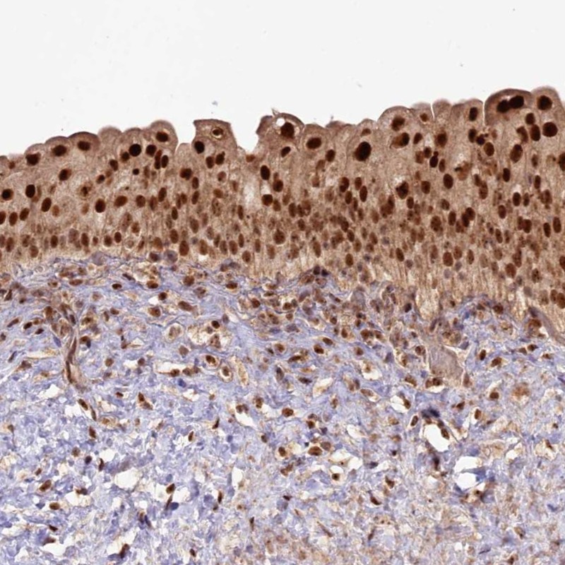 Atlas Antibodies Anti-RRP8 Antibody