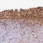 Atlas Antibodies Anti-RRP8 Antibody