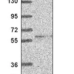 Atlas Antibodies Anti-RRP8 Antibody