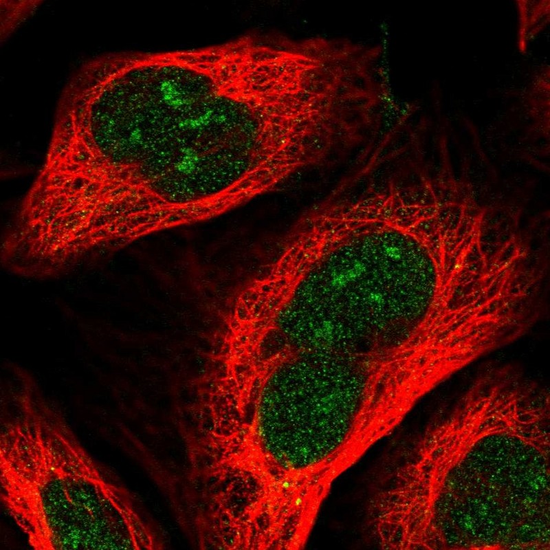 Atlas Antibodies Anti-RRP36 Antibody