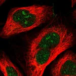 Atlas Antibodies Anti-RRP36 Antibody