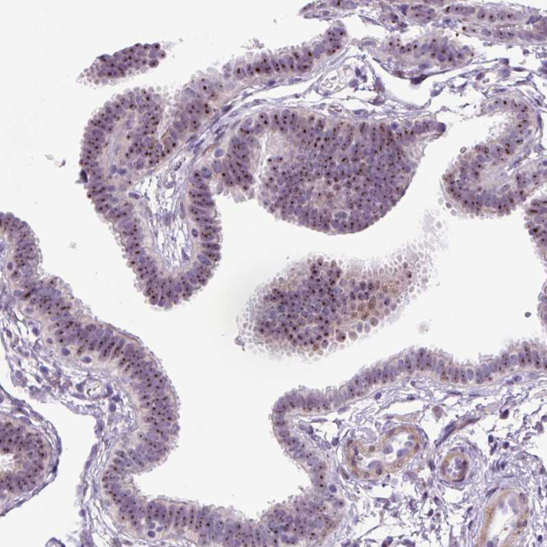 Atlas Antibodies Anti-RRS1 Antibody