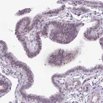 Atlas Antibodies Anti-RRS1 Antibody