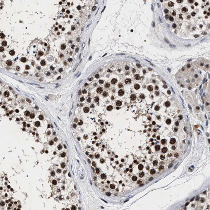 Atlas Antibodies Anti-RRP1B Antibody