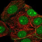 Atlas Antibodies Anti-RRP7A Antibody