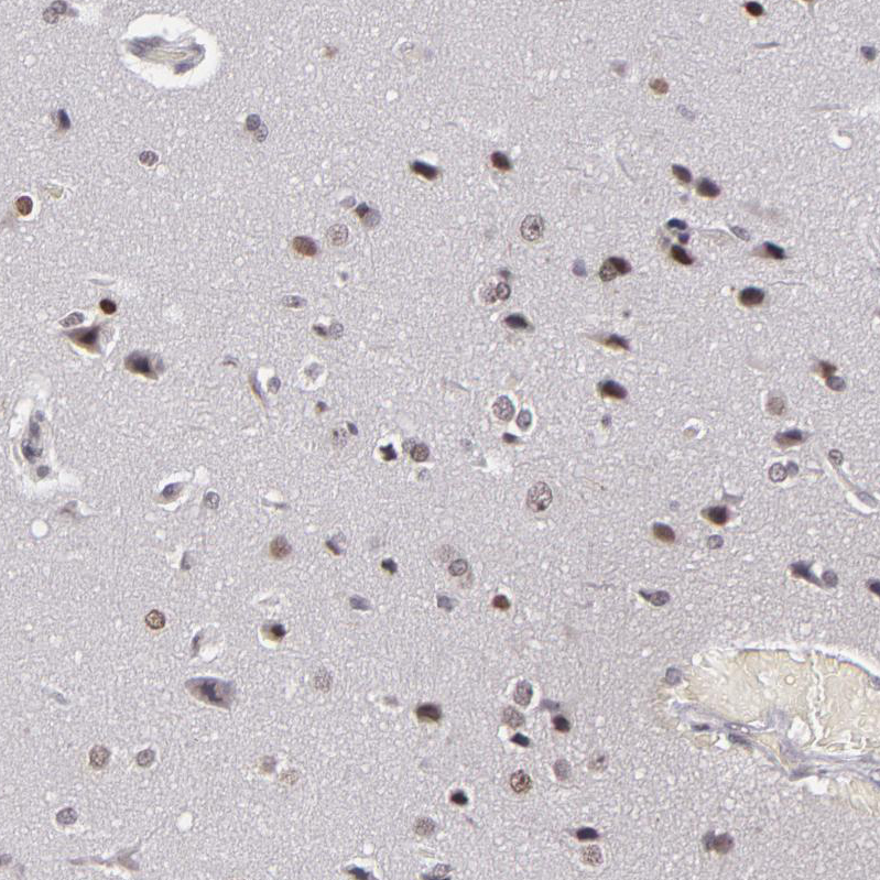 Atlas Antibodies Anti-RRP7A Antibody