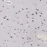 Atlas Antibodies Anti-RRP7A Antibody