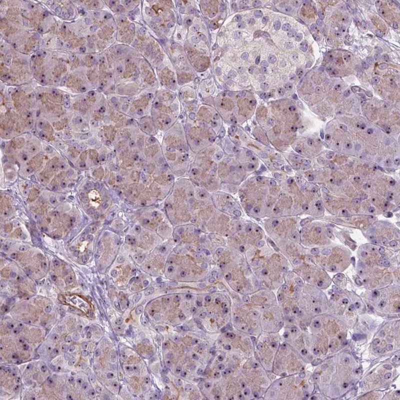 Atlas Antibodies Anti-RRS1 Antibody