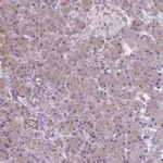 Atlas Antibodies Anti-RRS1 Antibody