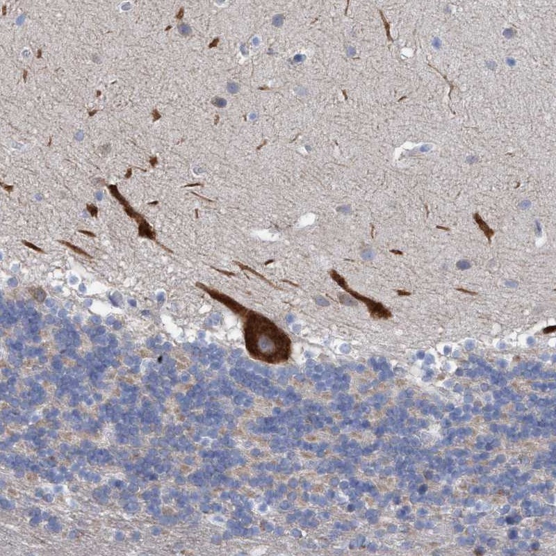 Atlas Antibodies Anti-RSAD1 Antibody