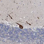 Atlas Antibodies Anti-RSAD1 Antibody
