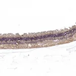 Atlas Antibodies Anti-RS1 Antibody