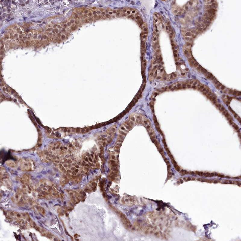Atlas Antibodies Anti-RSBN1 Antibody