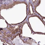 Atlas Antibodies Anti-RSBN1 Antibody